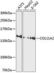 Western blot - COL11A2 Rabbit pAb (A10473)