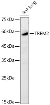 TREM2 Rabbit polyclonal antibody