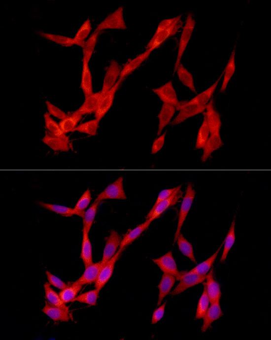 TREM2 Rabbit polyclonal antibody