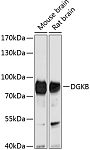 Western blot - DGKB Rabbit pAb (A10534)