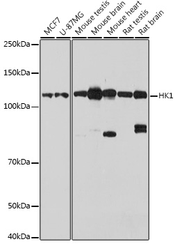 [KO Validated] HK1 Rabbit polyclonal antibody
