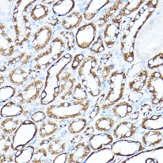 [KO Validated] HK1 Rabbit polyclonal antibody