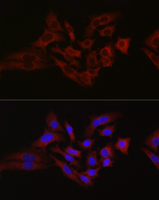 [KO Validated] HK1 Rabbit polyclonal antibody