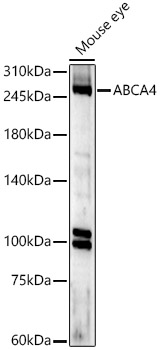 ABCA4 Rabbit polyclonal antibody