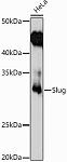 Western blot - Slug Rabbit pAb (A1057)