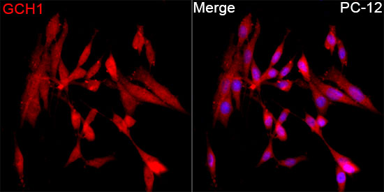 GCH1 Rabbit polyclonal antibody