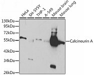 Western blot - Calcineurin A Rabbit pAb (A1063)