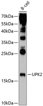 UPK2 Rabbit polyclonal antibody