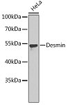 Western blot - Desmin Rabbit pAb (A10838)