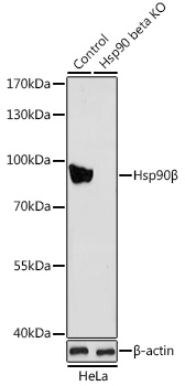 [KO Validated] Hsp90B Beta Rabbit polyclonal antibody