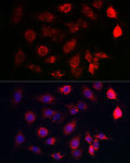 Western blot - SERCA2/ATP2A2 Rabbit pAb (A1097)