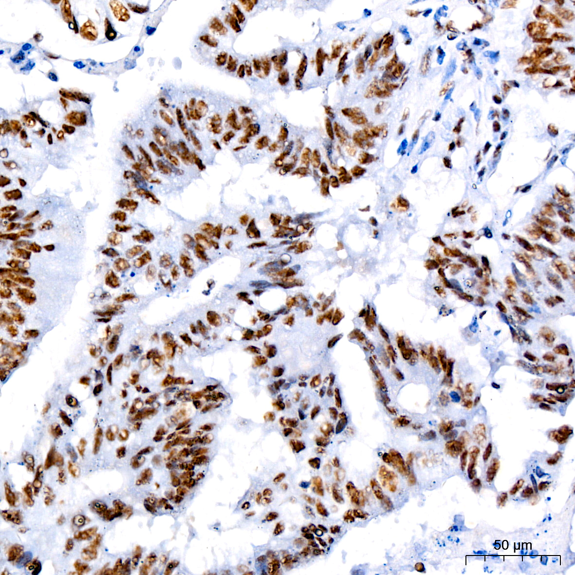 [KO Validated] CDK9 Rabbit monoclonal antibody