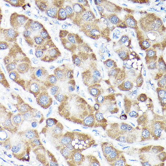 ABclonal:Immunohistochemistry - NRF2 Rabbit pAb (A11159)