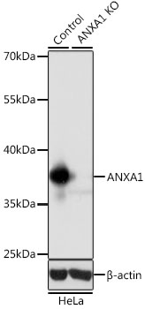[KO Validated] ANXA1 Rabbit polyclonal antibody