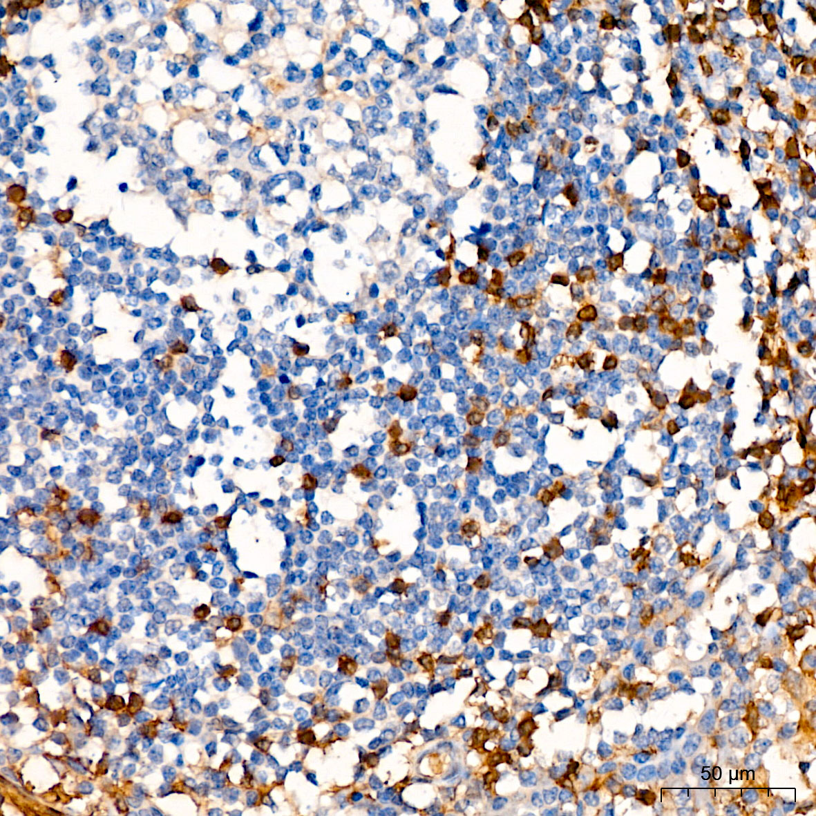 [KO Validated] ANXA1 Rabbit polyclonal antibody