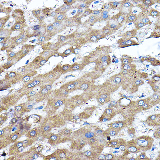 [KO Validated] ERK2 Rabbit polyclonal antibody