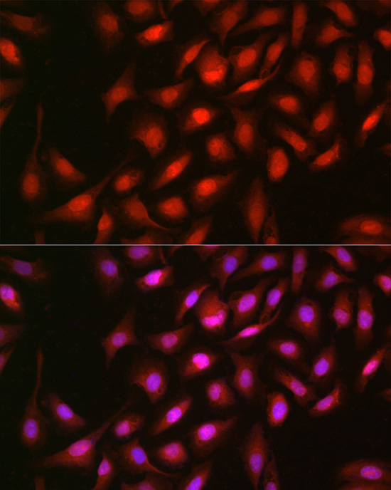 [KO Validated] ERK2 Rabbit polyclonal antibody