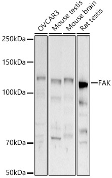 [KD Validated] FAK Rabbit polyclonal antibody