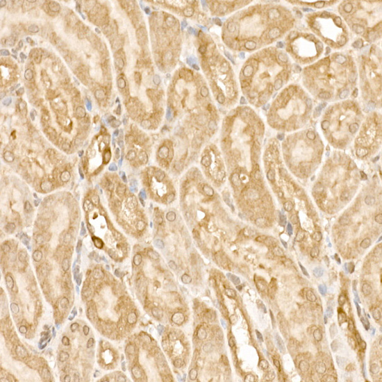 [KD Validated] FAK Rabbit polyclonal antibody