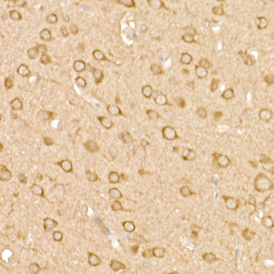 [KD Validated] FAK Rabbit polyclonal antibody