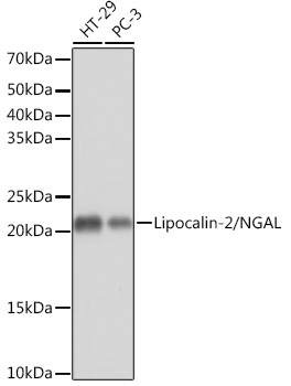 Lipocalin-2/NGAL Rabbit mAb