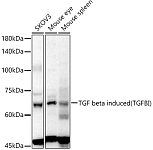 Western blot - TGF beta induced (TGFBI) Rabbit pAb (A11222)