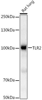 TLR2 Rabbit polyclonal antibody