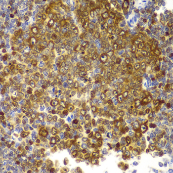 TLR2 Rabbit polyclonal antibody