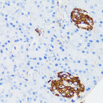 TLR2 Rabbit polyclonal antibody