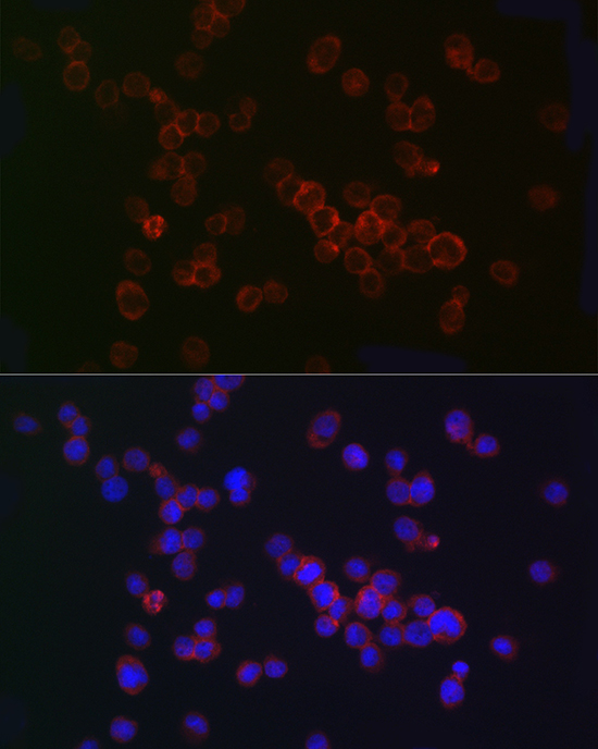 TLR2 Rabbit polyclonal antibody