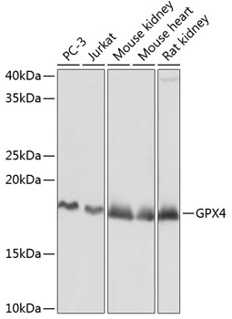 [KD Validated] GPX4 Rabbit monoclonal antibody