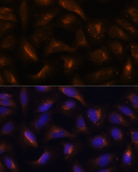 SQSTM1/p62 Rabbit pAb-Polyclonal Antibodies - ABclonal