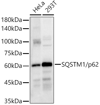 SQSTM1/p62 Rabbit pAb-Polyclonal Antibodies - ABclonal