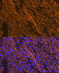 Western blot - Cardiac troponin T (TNNT2) Rabbit pAb (A1126)