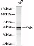 Western blot - YAP1 Rabbit pAb (A11265)