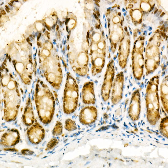[KO Validated] NADPH oxidase 4 (NOX4) Rabbit polyclonal antibody