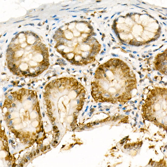 [KO Validated] NADPH oxidase 4 (NOX4) Rabbit polyclonal antibody