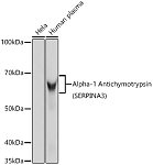 Western blot - Alpha-1 Antichymotrypsin (SERPINA3) Rabbit mAb (A11364)