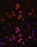 Immunofluorescence - IL1β Rabbit pAb (A11370)