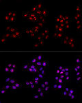 Immunofluorescence - Ki67 Rabbit pAb (A11390)