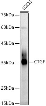 CTGF Rabbit polyclonal antibody