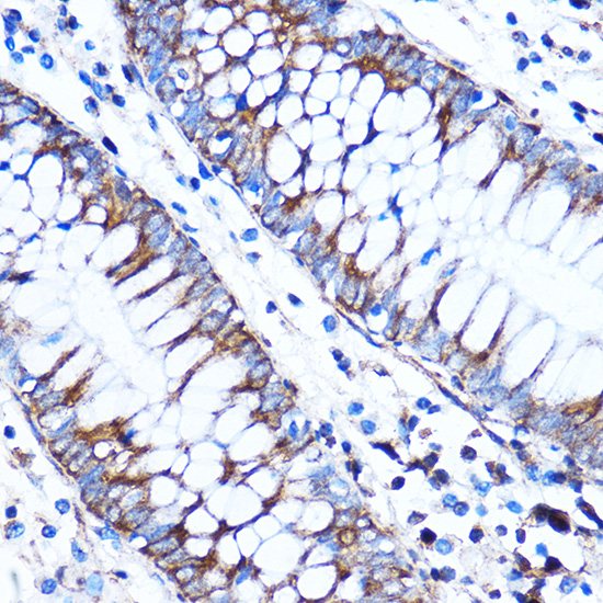 CTGF Rabbit polyclonal antibody