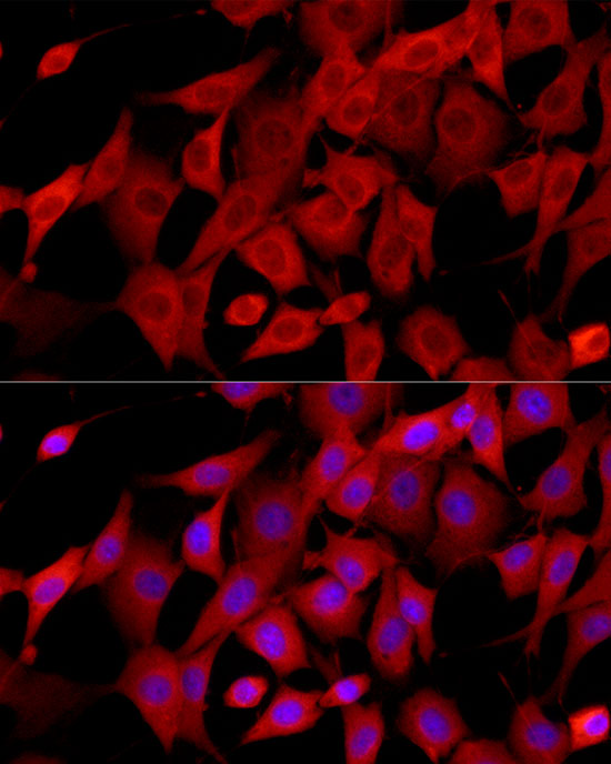 CTGF Rabbit polyclonal antibody