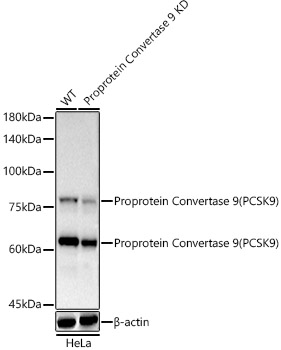 [KD Validated] Proprotein Convertase 9(PCSK9) Rabbit monoclonal antibody