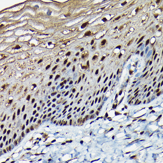 BRCA1 Rabbit polyclonal antibody