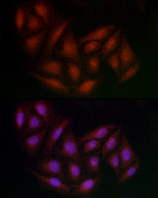 BRCA1 Rabbit polyclonal antibody