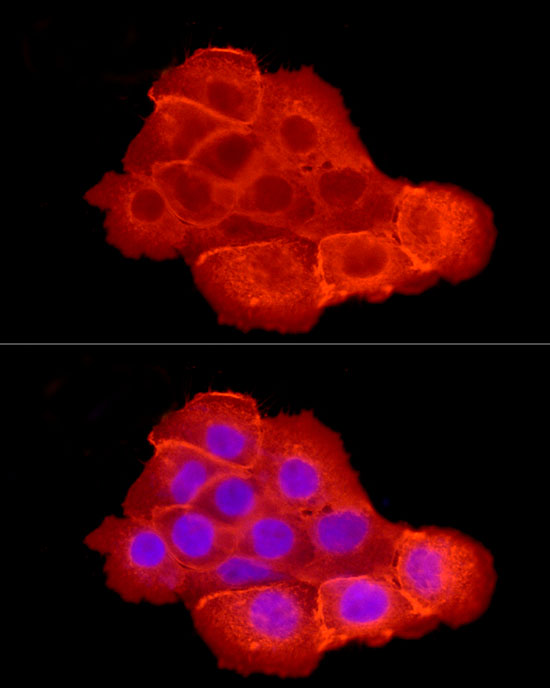 [KD Validated] EGFR Rabbit polyclonal antibody