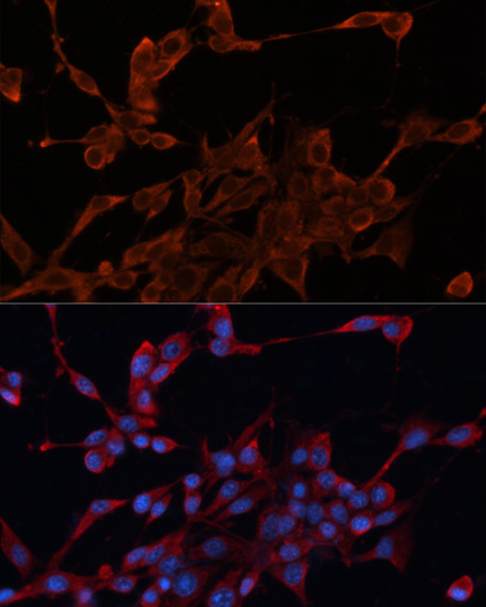 [KO Validated] DNAJA1 Rabbit polyclonal antibody