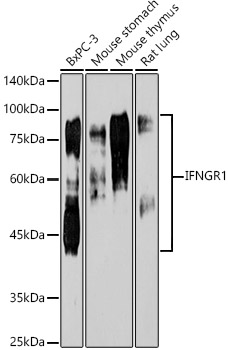 [KO Validated] IFNGR1 Rabbit monoclonal antibody