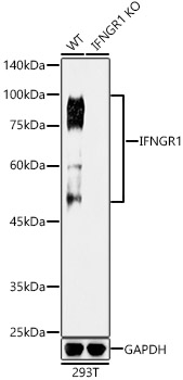 [KO Validated] IFNGR1 Rabbit monoclonal antibody